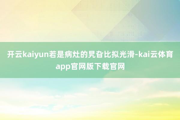 开云kaiyun若是病灶的旯旮比拟光滑-kai云体育app官网版下载官网